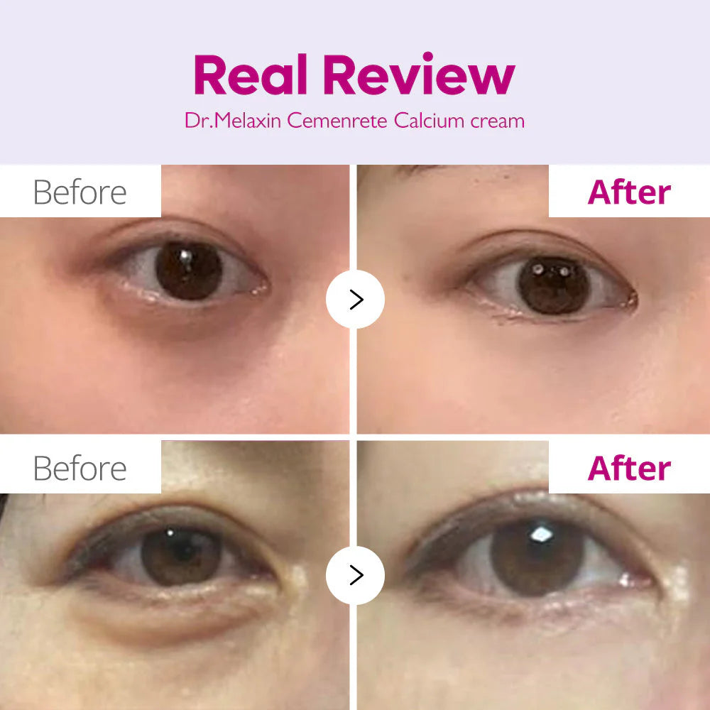 dr melaxin Cemenrete Calcium Intense Cream 50ml