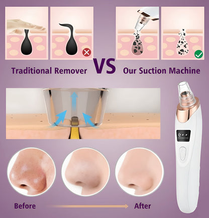 PrimeLux Electric Blackhead Remover – Clear Skin, Confident You