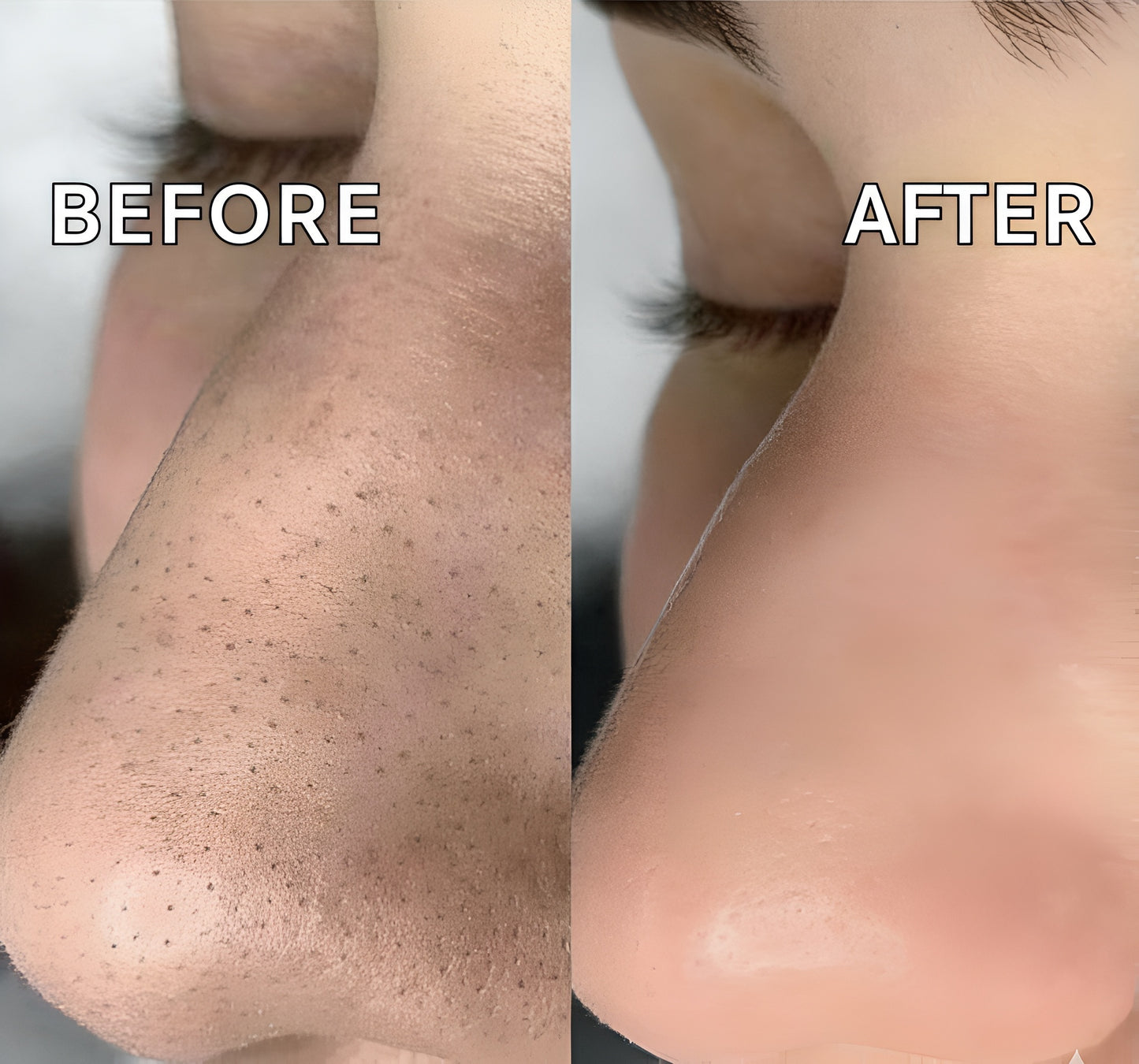 PrimeLux Electric Blackhead Remover – Clear Skin, Confident You