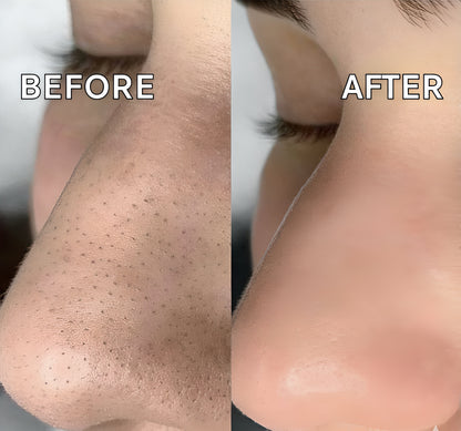 PrimeLux Electric Blackhead Remover – Clear Skin, Confident You