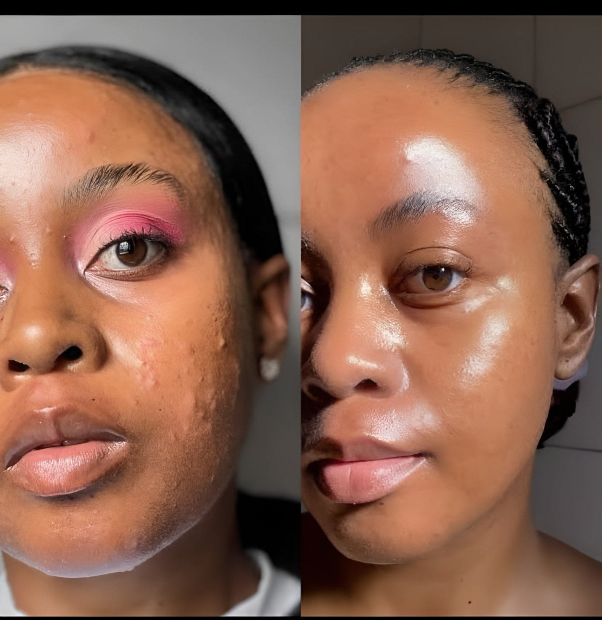 PrimeLux Radiance LED Face Mask – 7 Light Modes