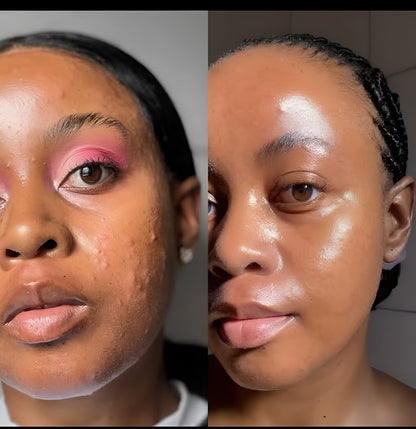 Clinically-Inspired LED Mask for Clearer, Brighter, Firmer Skin at Home in Just Minutes