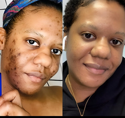 Clinically-Inspired LED Mask for Clearer, Brighter, Firmer Skin at Home in Just Minutes