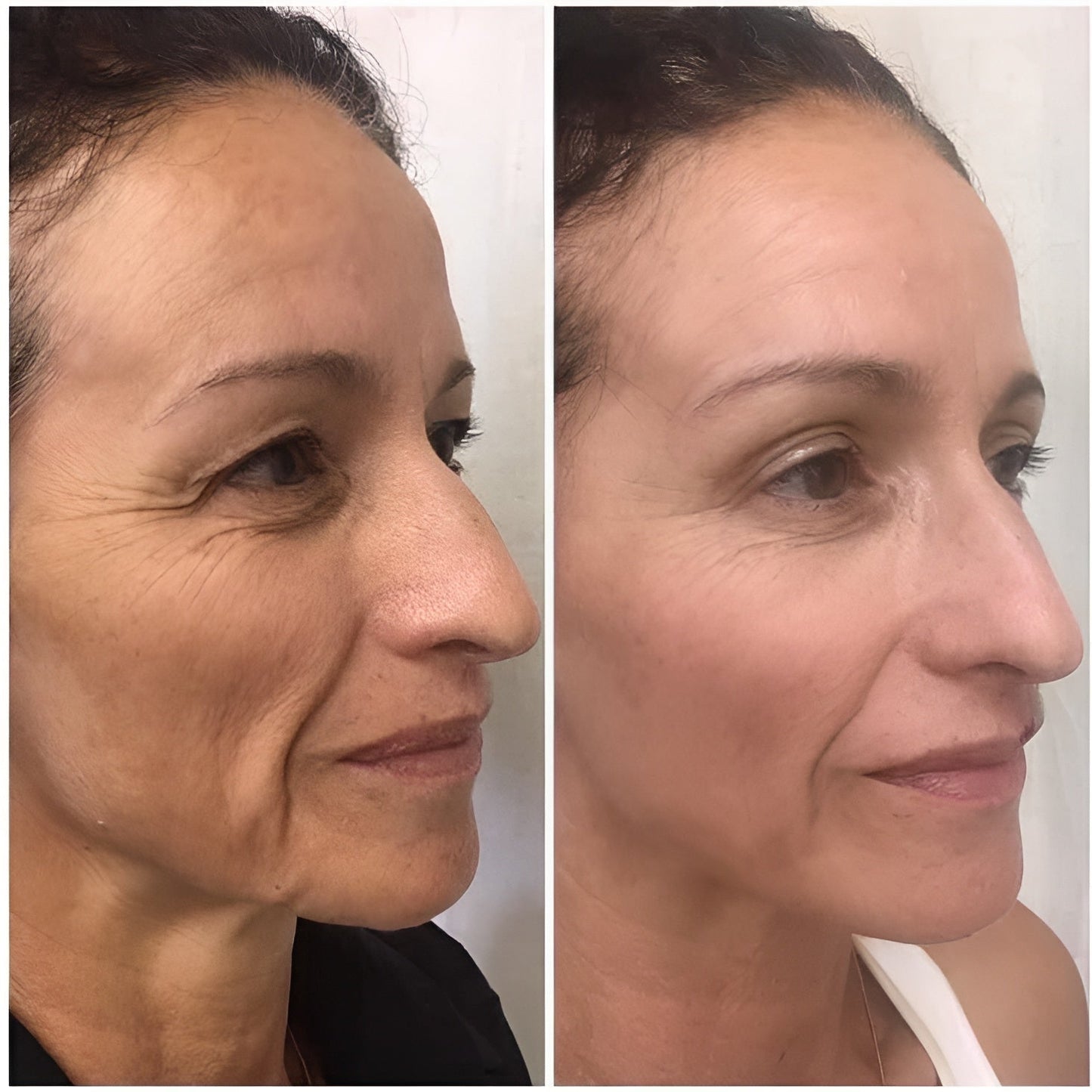 Clinically-Inspired LED Mask for Clearer, Brighter, Firmer Skin at Home in Just Minutes