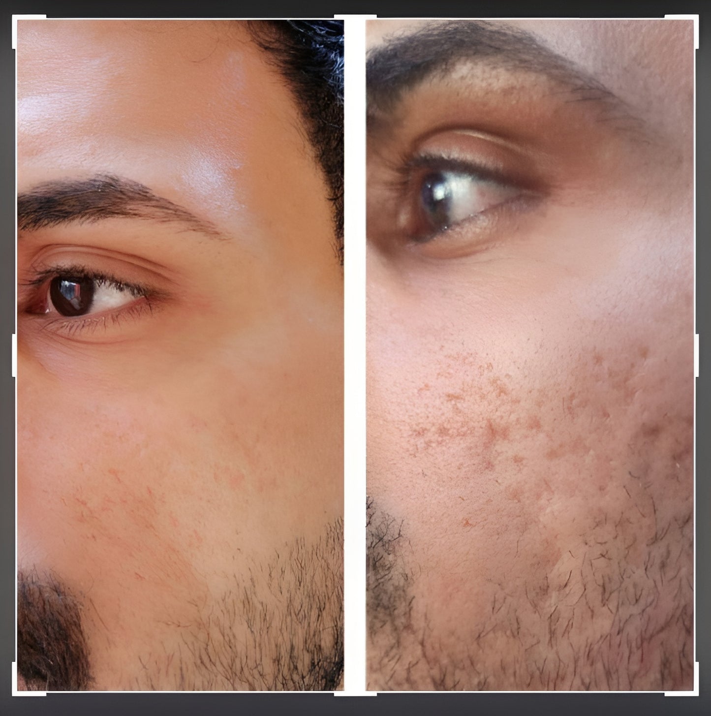 Clinically-Inspired LED Mask for Clearer, Brighter, Firmer Skin at Home in Just Minutes