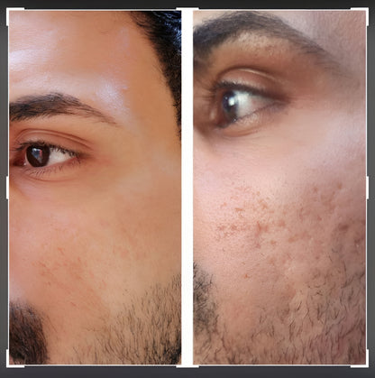 Clinically-Inspired LED Mask for Clearer, Brighter, Firmer Skin at Home in Just Minutes