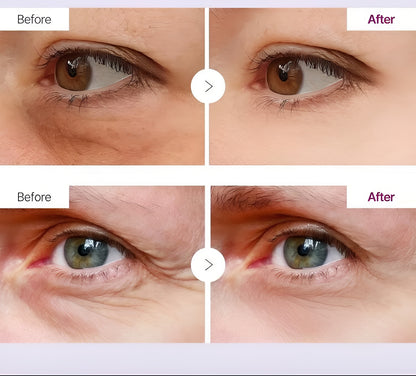 Erase Wrinkles & Dark Circles in Seconds — Dr. Melaxin Glow Balm