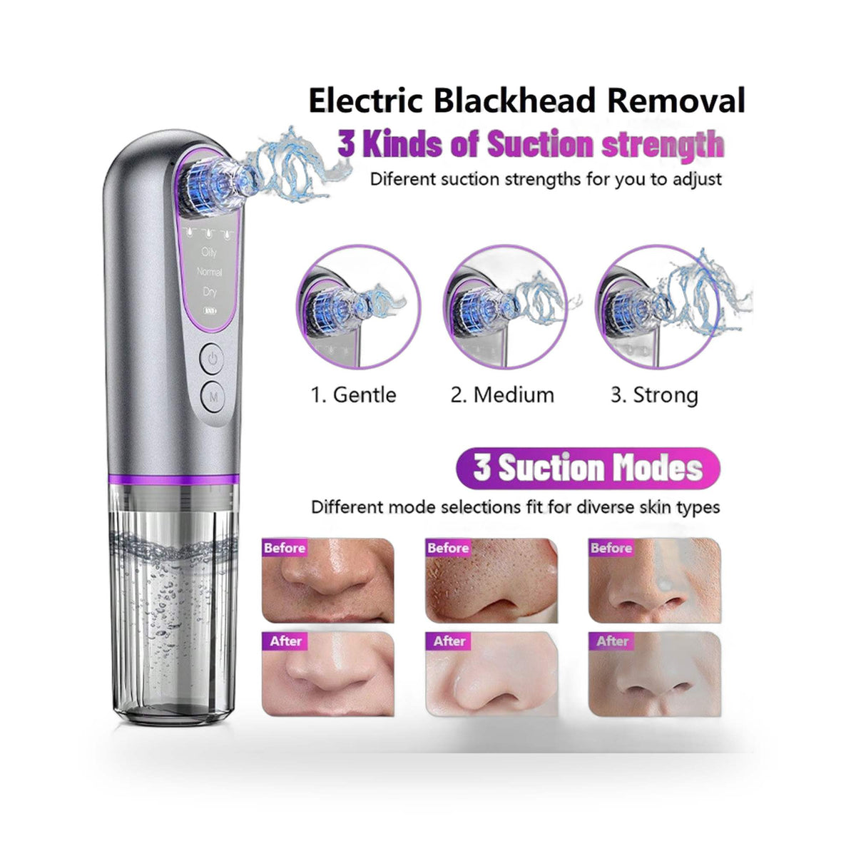 PrimeLux Water-Cycle Blackhead Vacuum