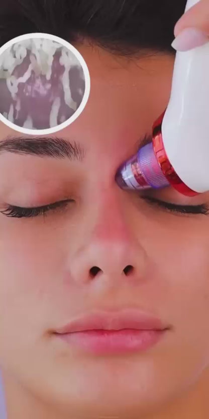 PrimeLux Electric Blackhead Remover – Clear Skin, Confident You