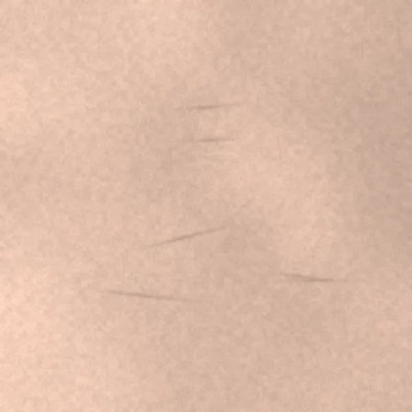 Fine lines & firmness: illustrative after image