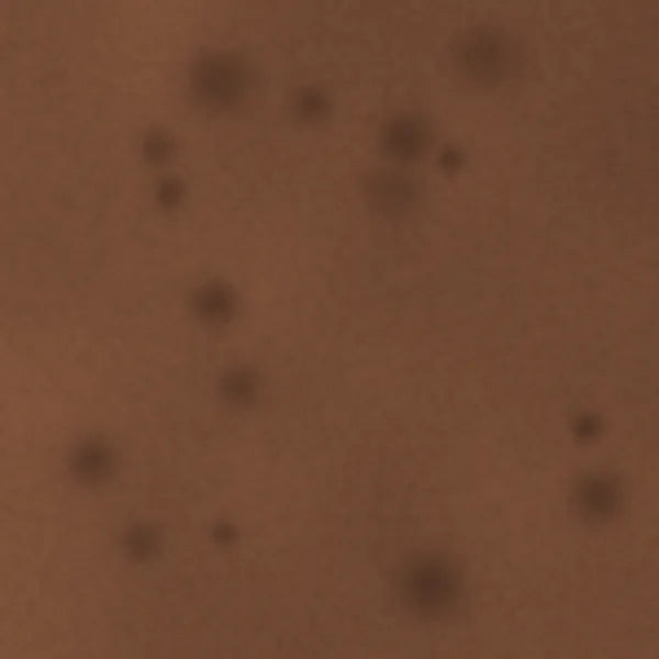 Dark spots: illustrative before image