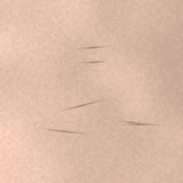 Fine lines & firmness: illustrative before image